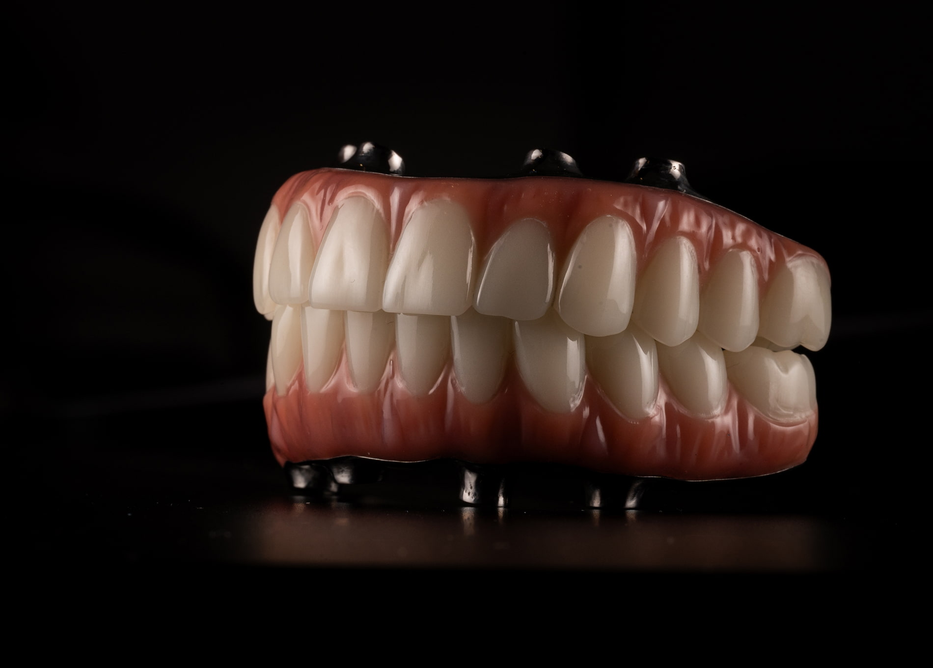 Full-mouth implants, implant-supported dentures, and custom dental bridges options