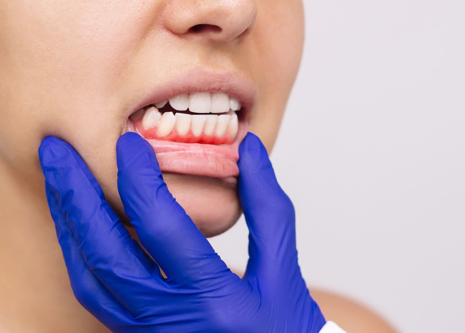 Recognizing gum disease risk factors like age, smoking, and poor oral hygiene